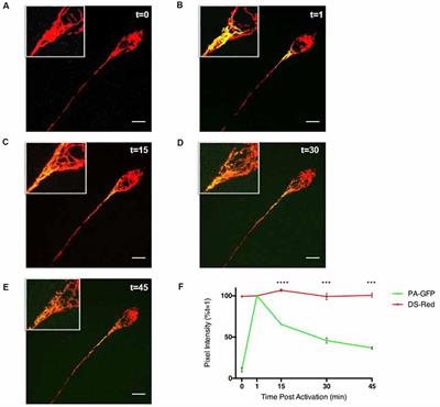 Dichloroacetate Stabilizes Mitochondrial Fusion Dynamics in Models of Neurodegeneration